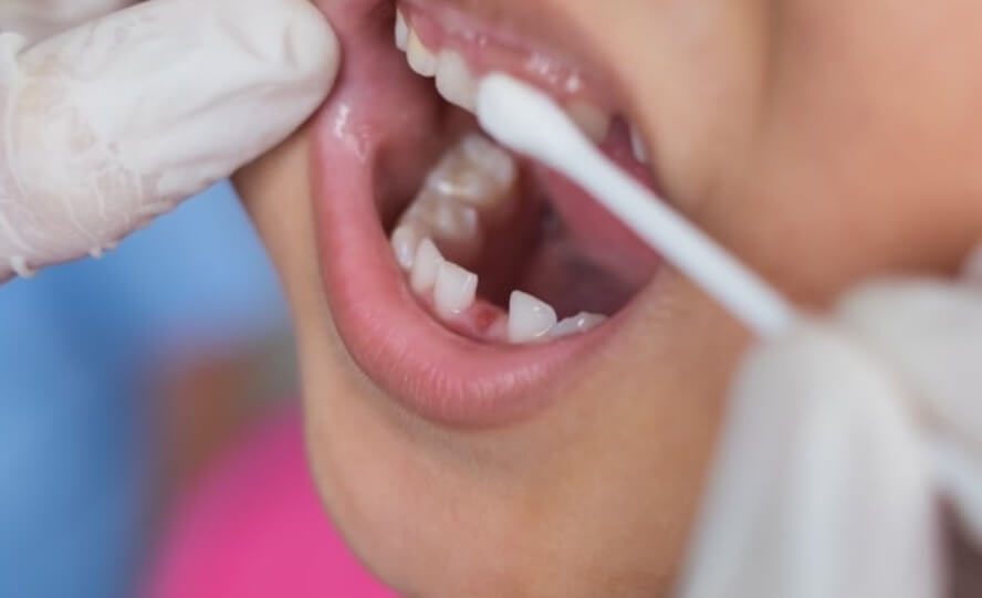 стоматологическая помощь канада
