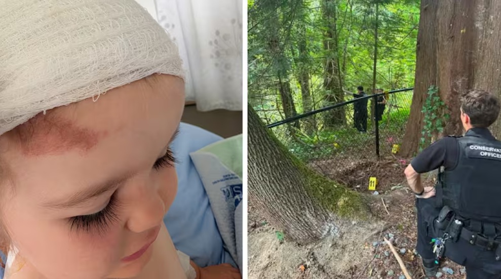 атака медведя | Наш Ванкувер Left: child with a gauze head bandage and bruising on the forehead; Right: conservation officer in a forest near a fence with yellow evidence markers.