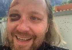 Close-up of a smiling man with long hair and a beard outdoors on a sunny day.