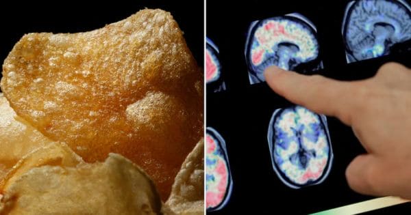 Split image: left panel shows a golden fried potato chip; right panel a finger points at colorful brain MRI scans highlighting areas of interest.